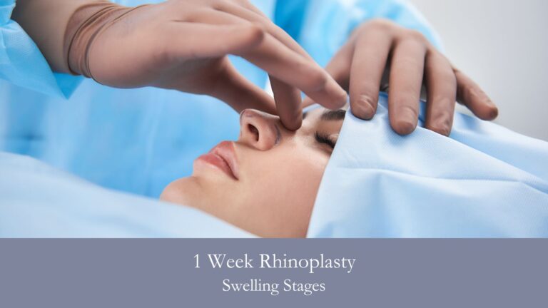 1 Week Rhinoplasty Swelling Stages