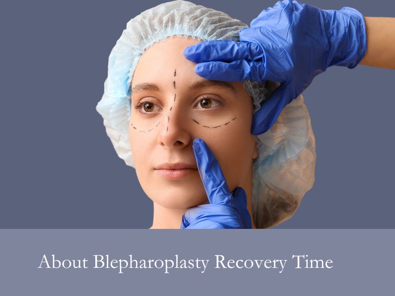 About Blepharoplasty Recovery Time