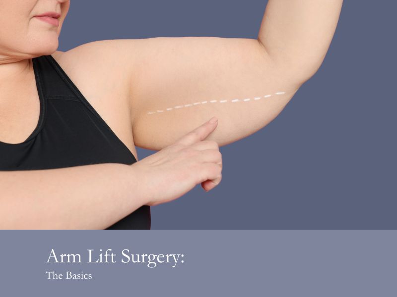Arm Lift Surgery- The Basics