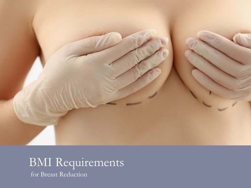 BMI Requirements for Breast Reduction