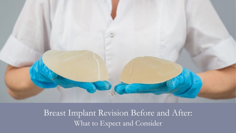 Breast Implant Revision Before and After- What to Expect and Consider