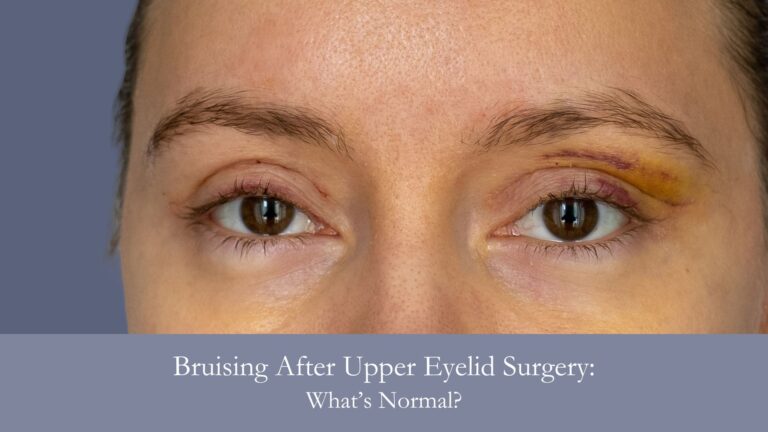Bruising After Upper Eyelid Surgery What’s Normal