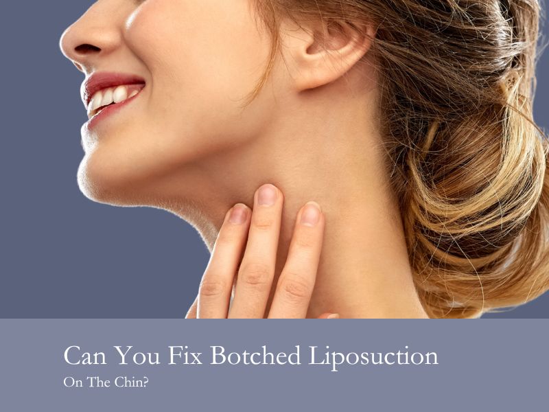 Can You Fix Botched Liposuction On The Chin?