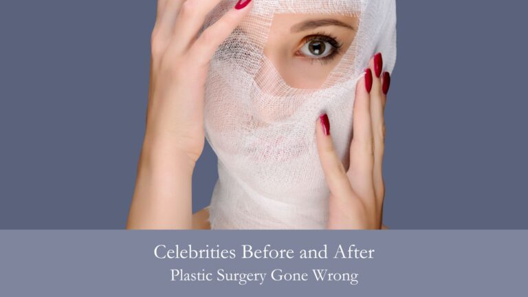 Celebrities Before and After Plastic Surgery Gone Wrong