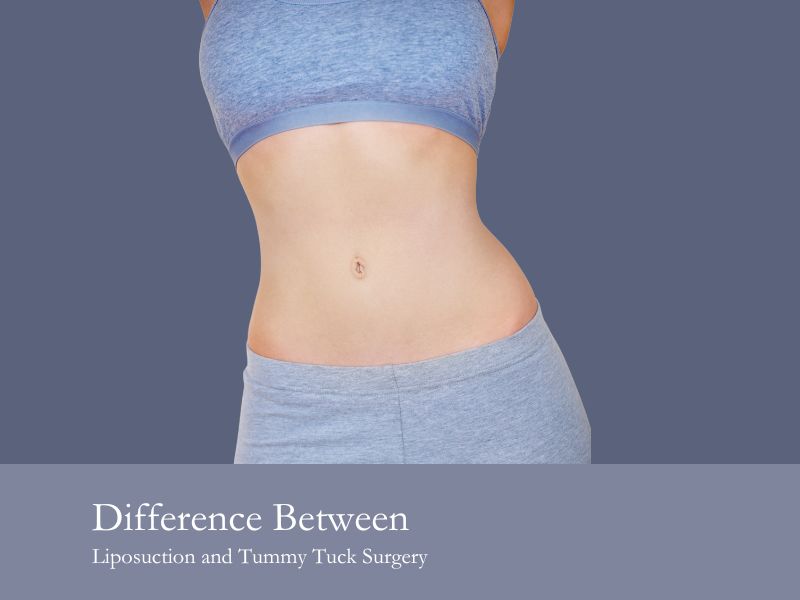 Difference Between Liposuction and Tummy Tuck Surgery
