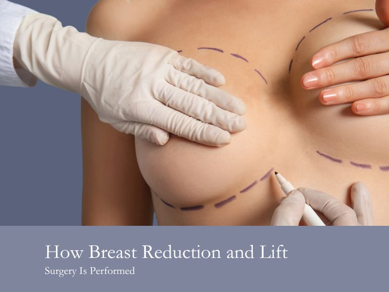How Breast Reduction and Lift Surgery Is Performed