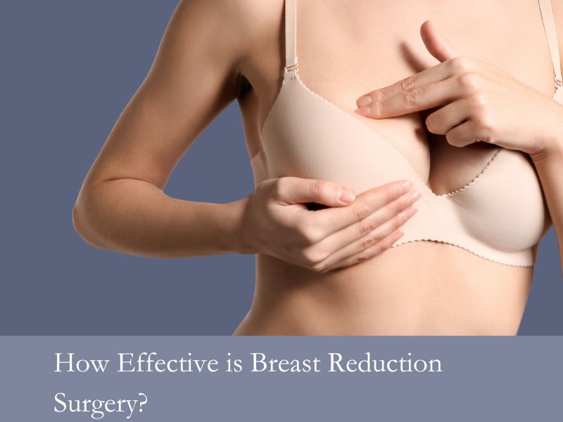 How Effective is Breast Reduction Surgery