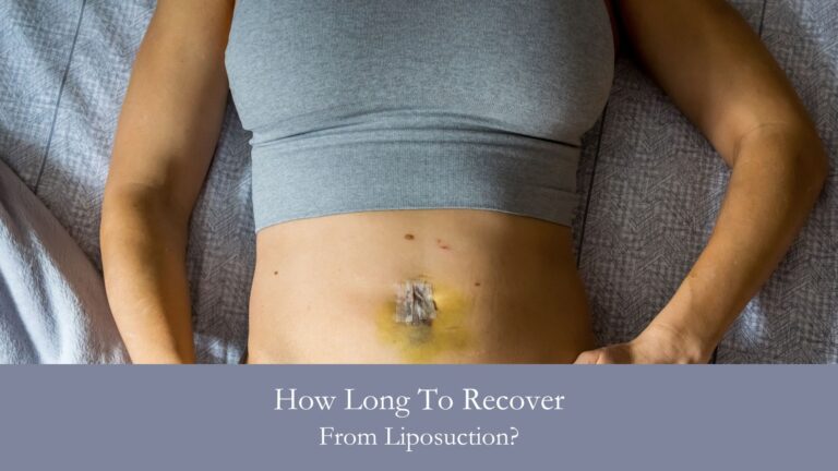 How Long To Recover From Liposuction?