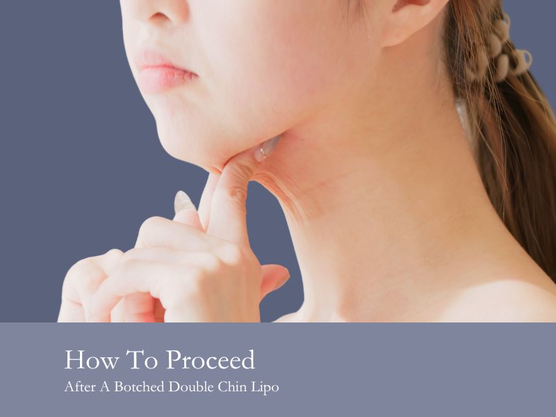 How To Proceed After A Botched Double Chin Lipo