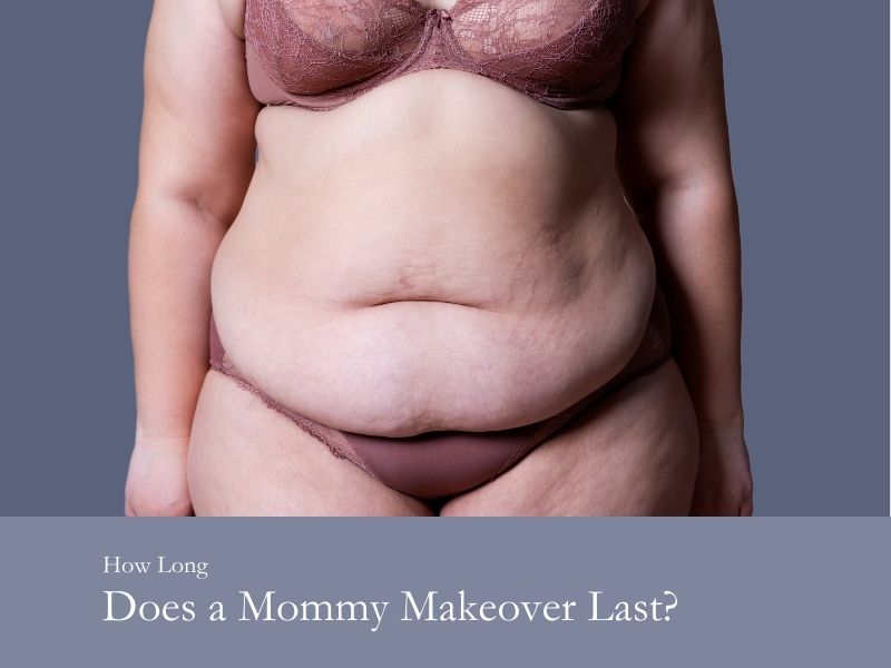 How long does a mommy makeover last