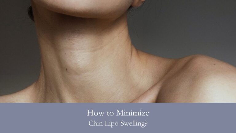 How to Minimize Chin Lipo Swelling