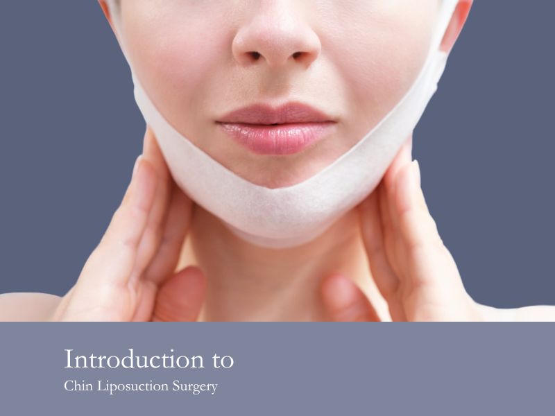Introduction to Chin Liposuction Surgery