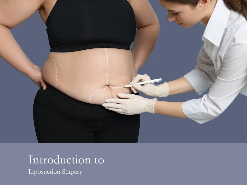 Introduction to Liposuction Surgery