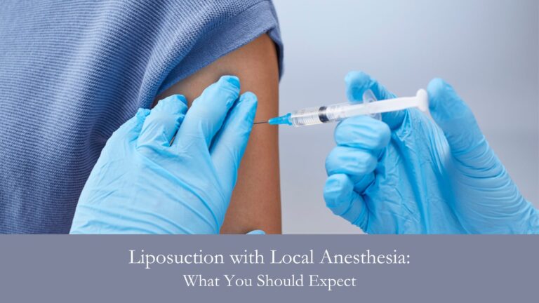 Liposuction with Local Anesthesia- What You Should Expect