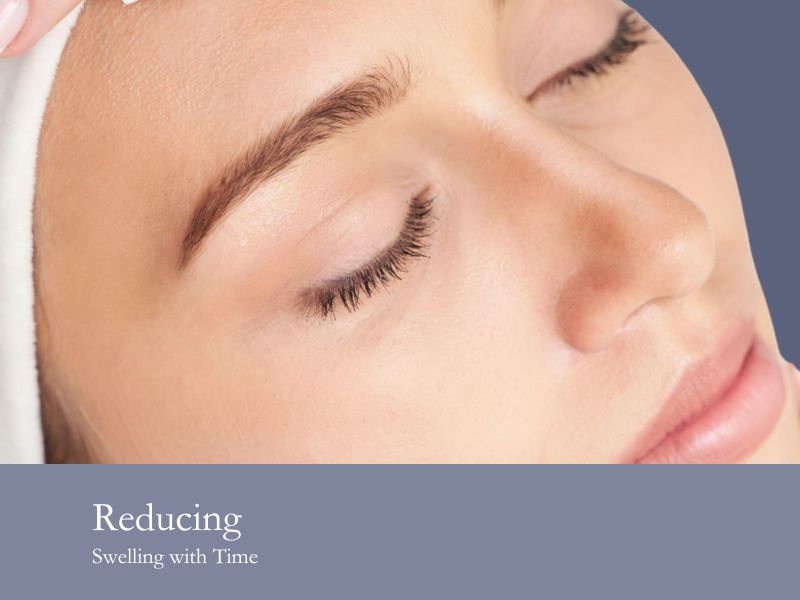 Reducing Swelling with Time