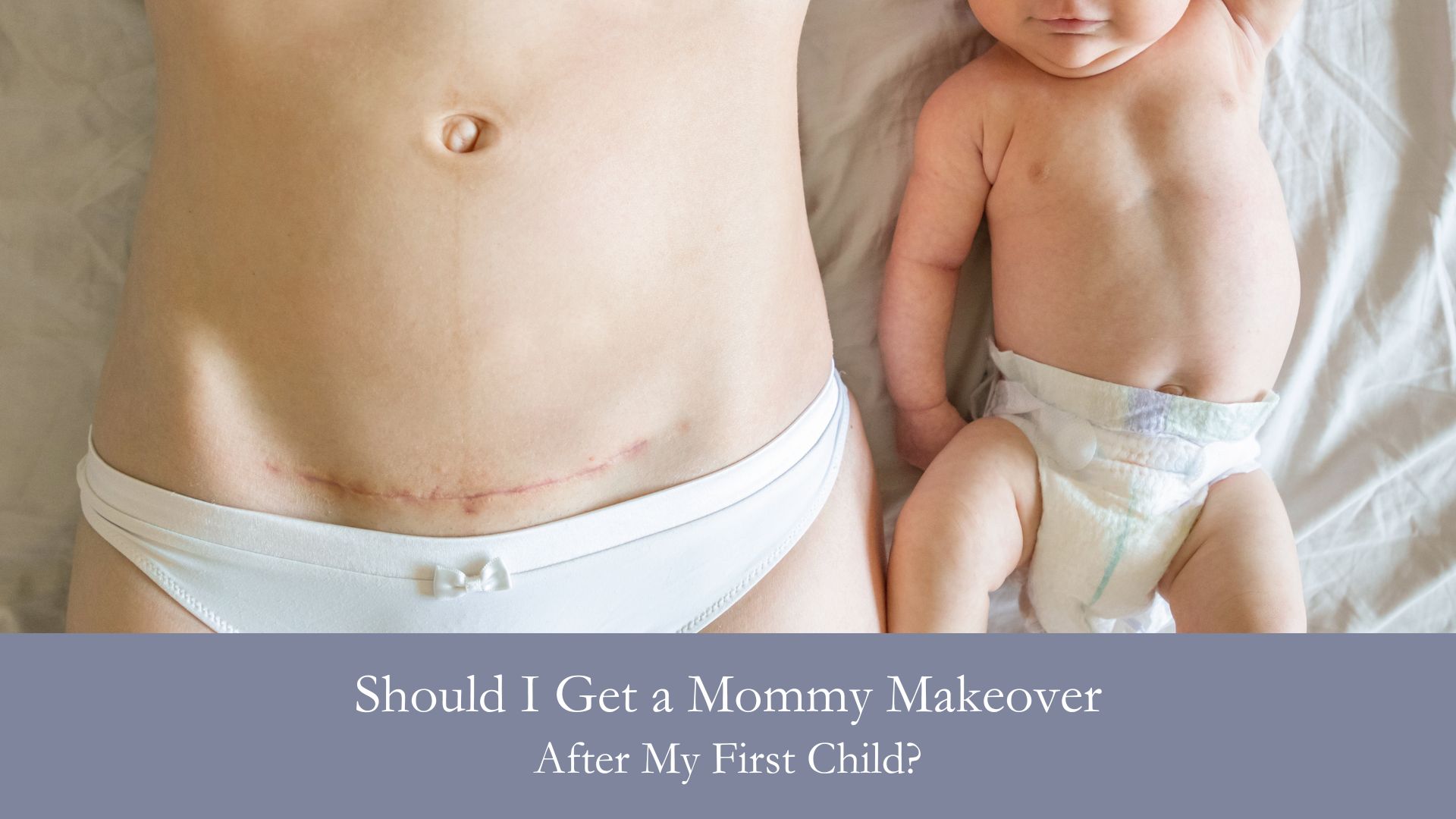 Should I Get a Mommy Makeover After My First Child?