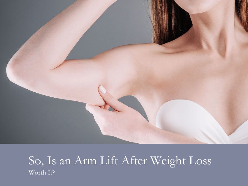 So, Is an Arm Lift After Weight Loss Worth It?