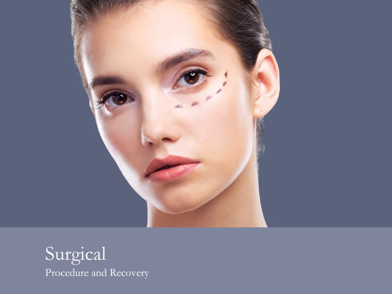 Surgical Procedure and Recovery