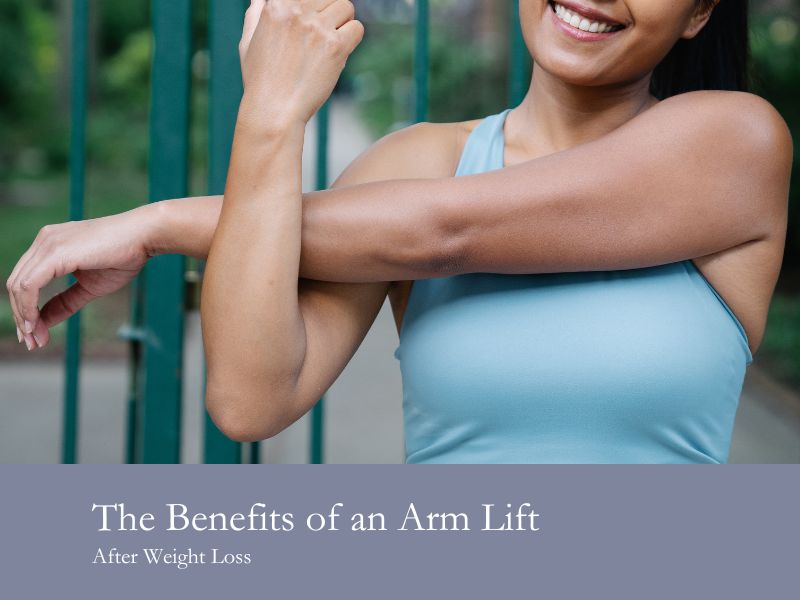 The Benefits of an Arm Lift After Weight Loss