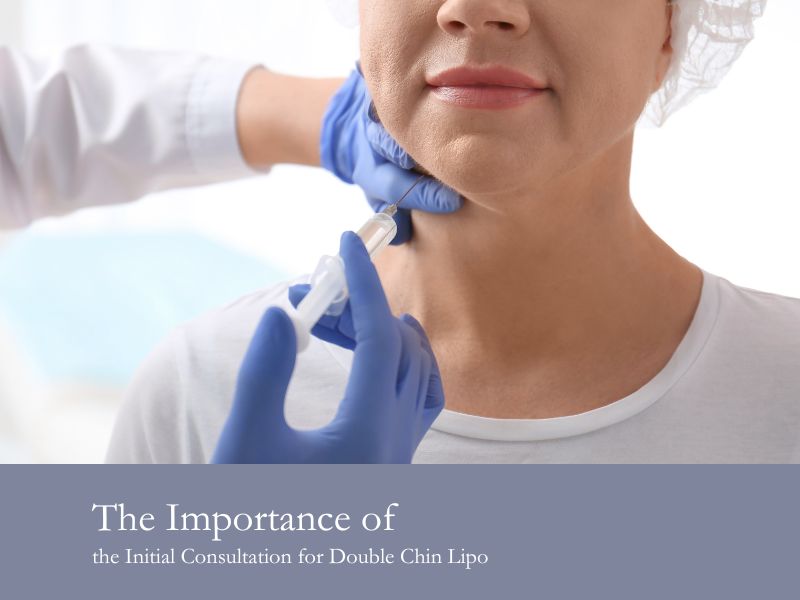 The Importance of the Initial Consultation for Double Chin Lipo