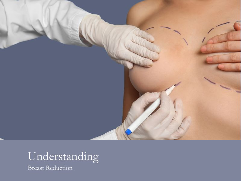 Understanding Breast Reduction