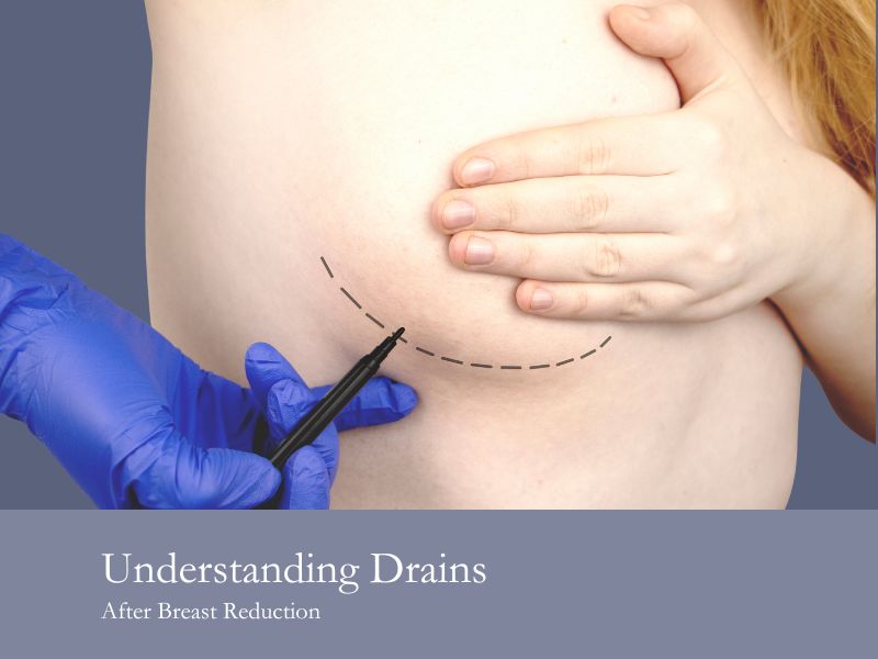 Understanding Drains After Breast Reduction