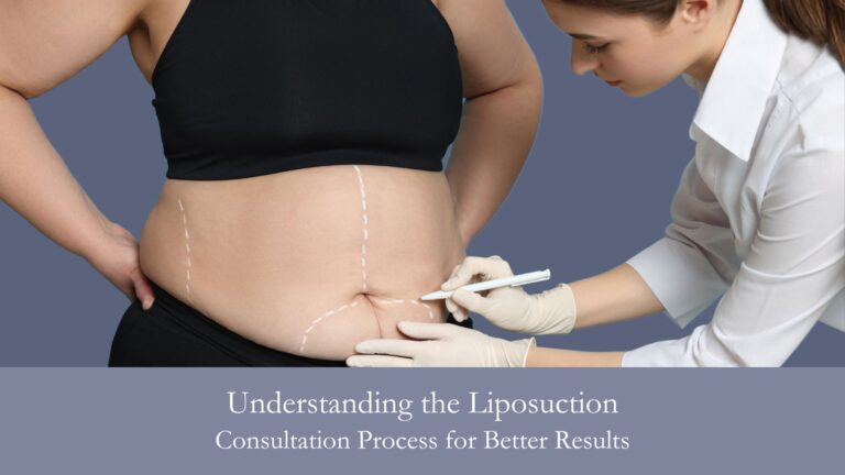 Understanding the Liposuction Consultation Process for Better Results