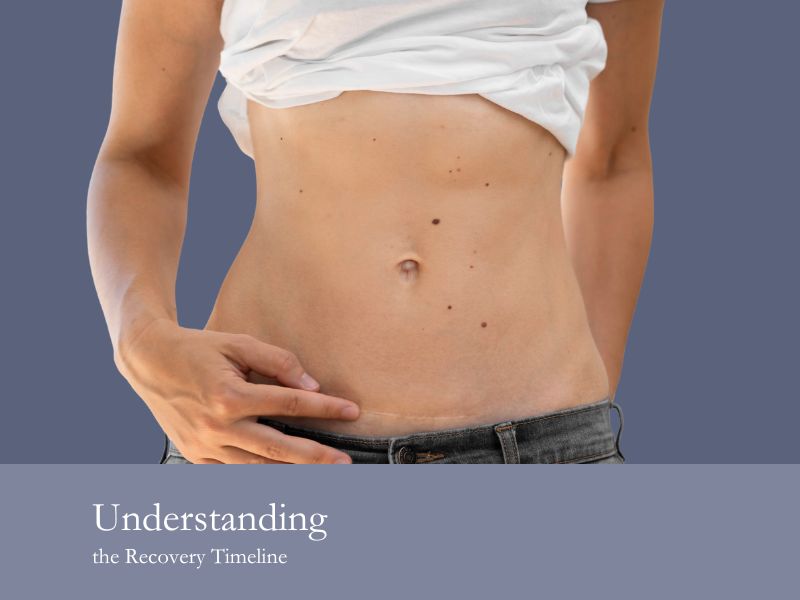 Understanding the Recovery Timeline