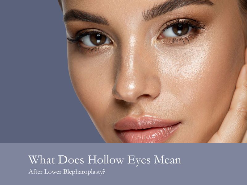 What Does Hollow Eyes Mean After Lower Blepharoplasty