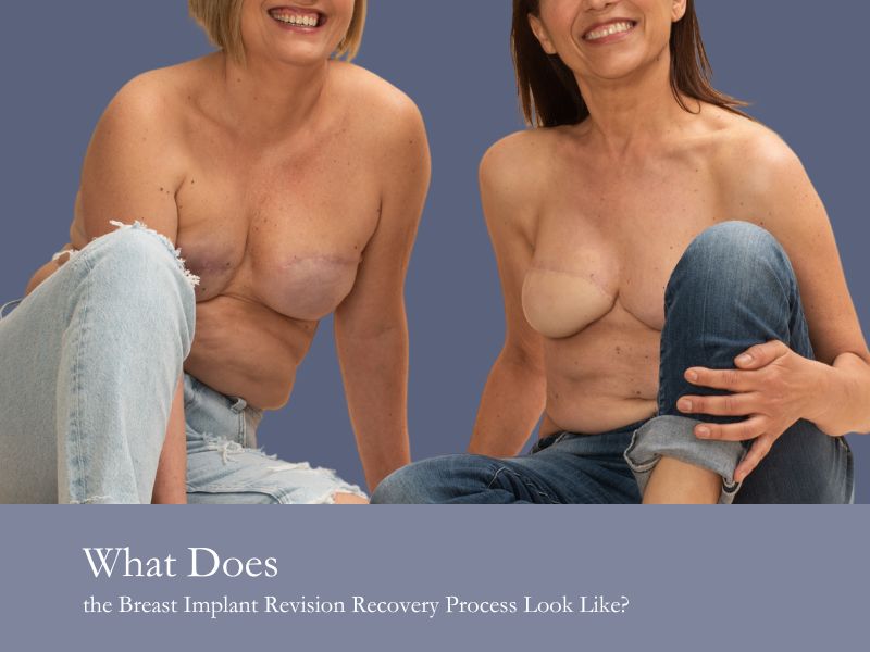 What Does the Breast Implant Revision Recovery Process Look Like?