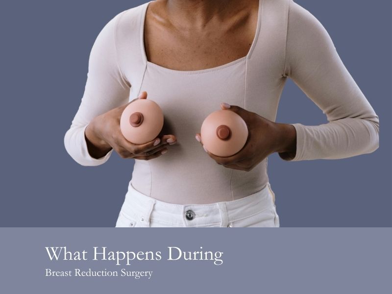 What Happens During Breast Reduction Surgery
