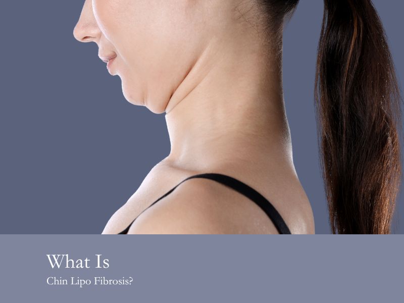 What Is Chin Lipo Fibrosis