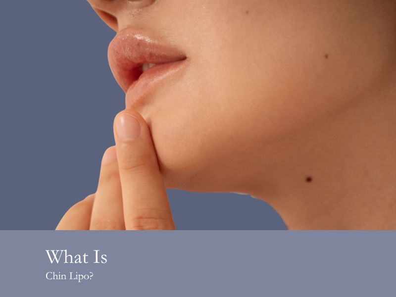What Is Chin Lipo