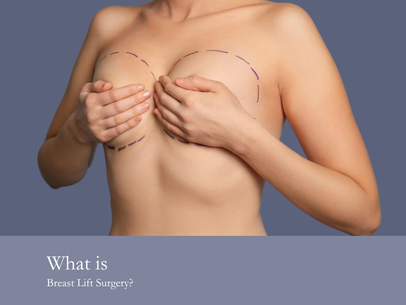 What is Breast Lift Surgery?