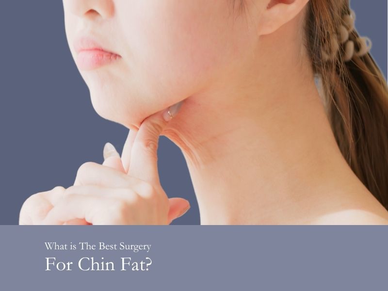 What is the best surgery for chin fat