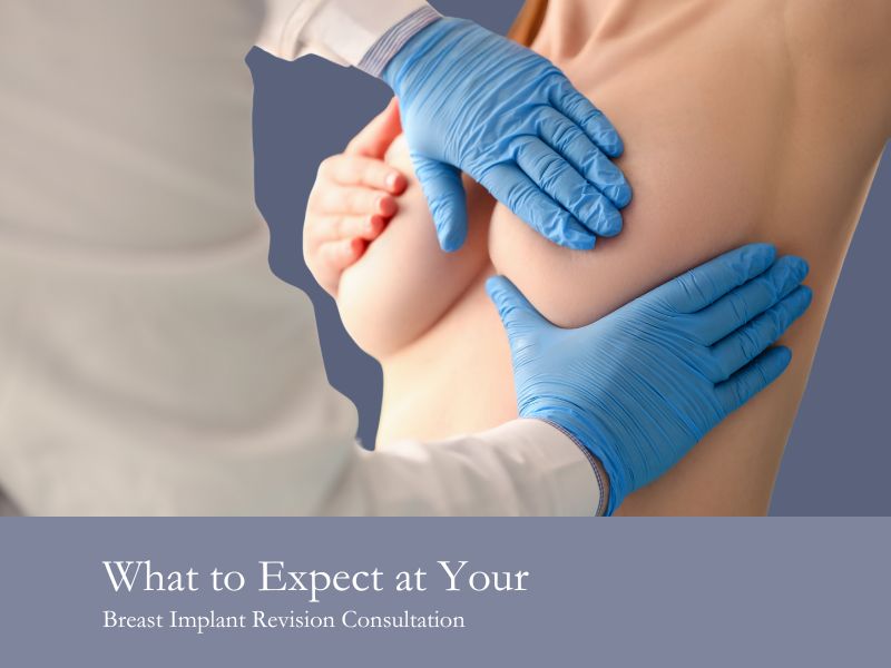 What to Expect at Your Breast Implant Revision Consultation