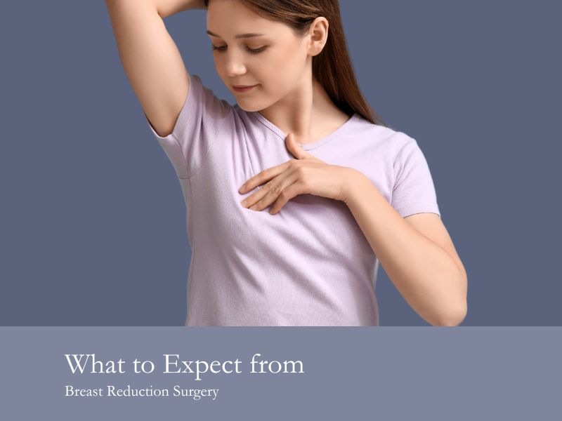 What to Expect from Breast Reduction Surgery