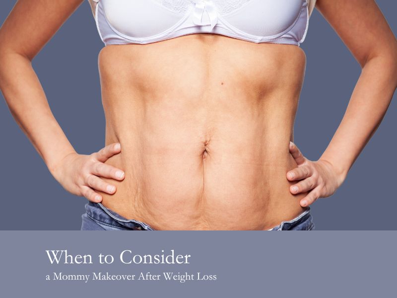When to Consider a Mommy Makeover After Weight Loss