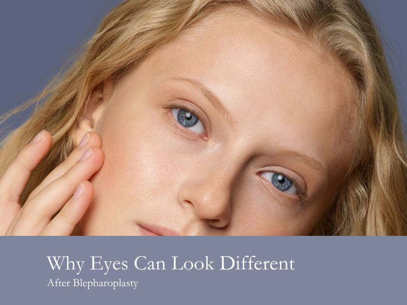 Why Eyes Can Look Different After Blepharoplasty
