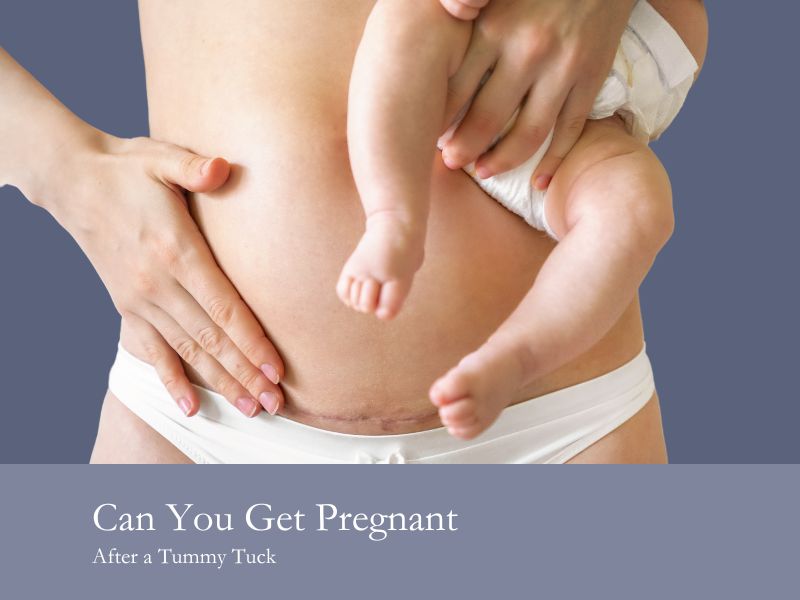 can you get pregnant after a tummy tuck