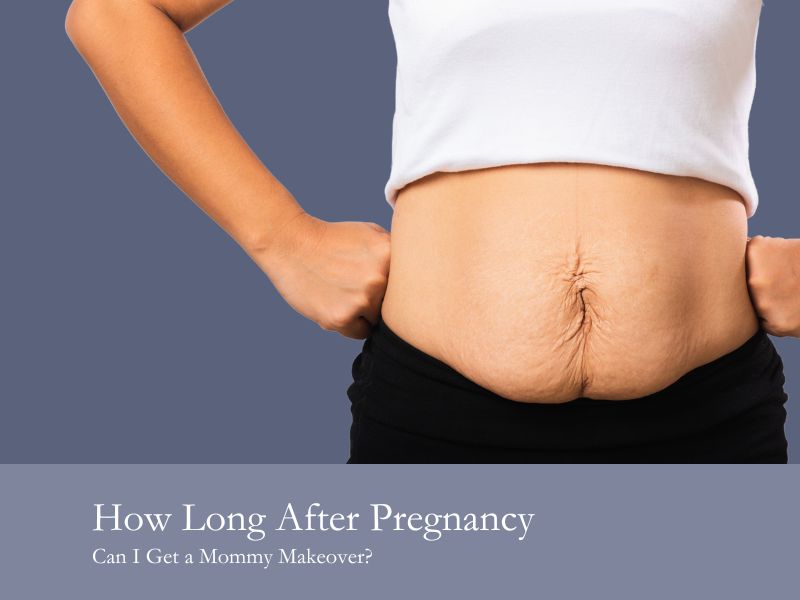 how long after pregnancy can i get a mommy makeover