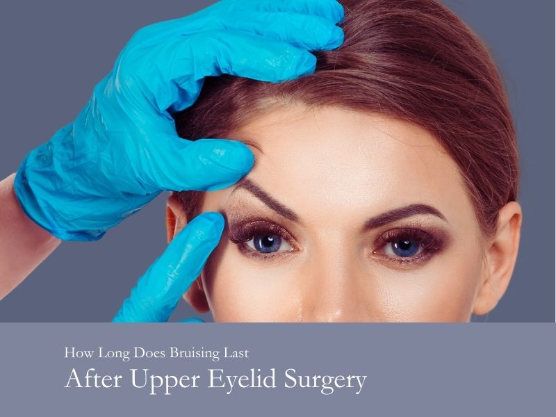 how long does bruising last after upper eyelid surgery